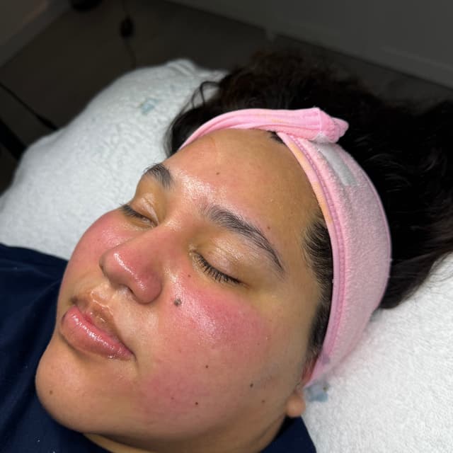 Halo Facial Club at HALO SKN ESTHETICS in Killeen, TX
